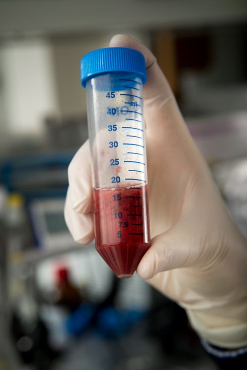image of vial of blood