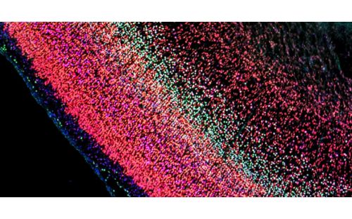 Cell Seek provides a path to understanding the cellular origins of brain tumors