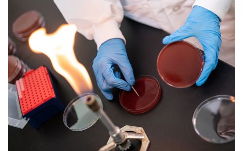 Scientist in lab wearing gloves and with bunsen burner on
