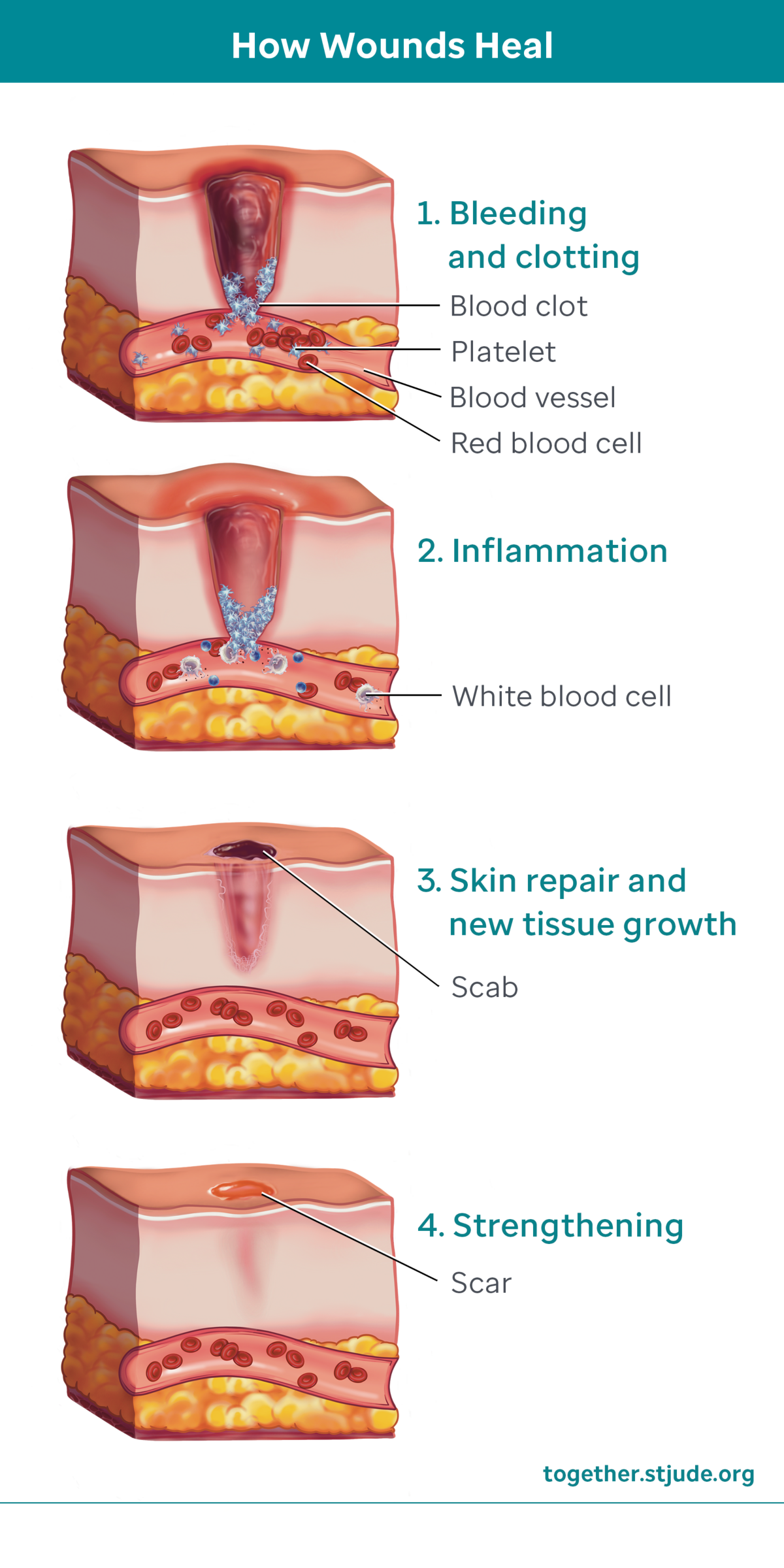 does tobacco slow down healing Delayed Wound Healing