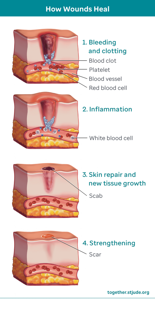 stages of how wounds heal