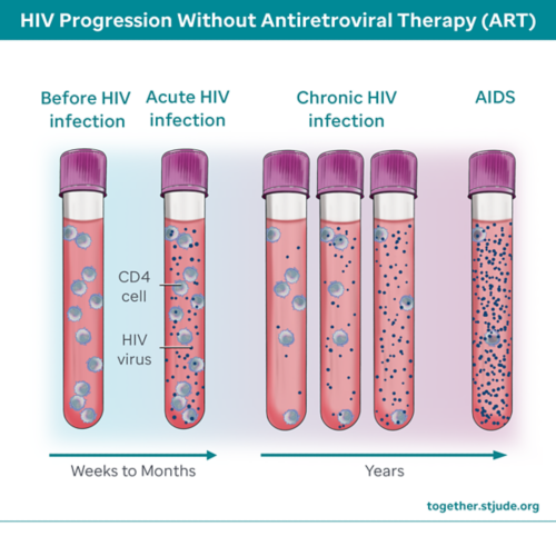 Vials of blood showing before HIV infection leading to chronic HIV infection and AIDS