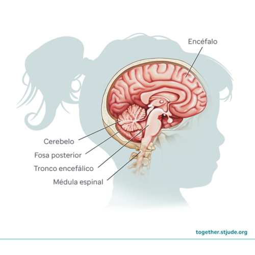 Anatomía de los tumores cerebrales y de la médula espinal