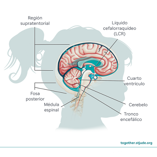 Anatomía cerebral del ependimoma