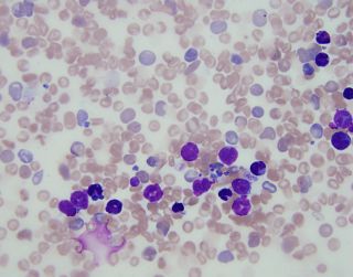 Circulating leukemic blasts in a genetic mouse model of AML 