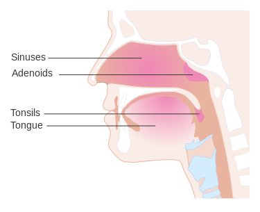 En esta ilustración, se muestra la ubicación de las adenoides y las amígdalas. Utilizado con el permiso de Cancer Research UK/Wikimedia Common.