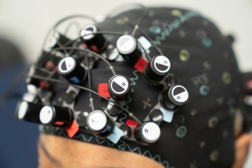 The sensors on this specially designed cap show how blood moves in the brain and measures oxygen levels.