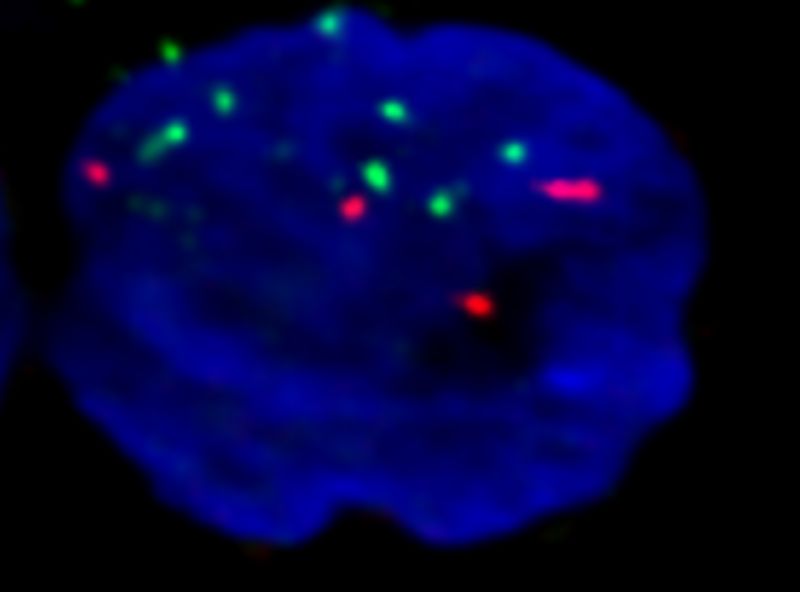 image of chromosomes