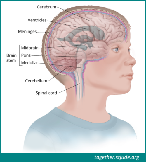 神经胶质瘤是一种脑肿瘤，最常在大脑中形成。