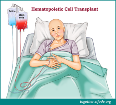 allogeneic hematopoietic cell transplantation