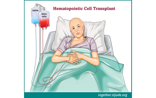 Illustration of cancer patient in hospital bed undergoing stem cell transplant