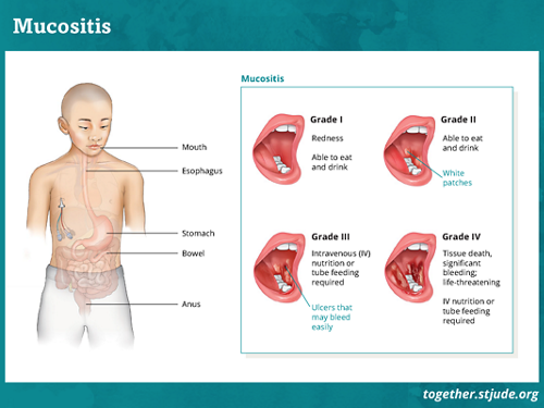 what causes blisters in throat