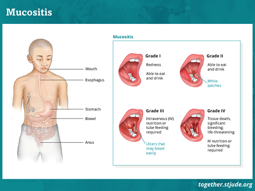 What is mucositis? Mucositis is a swelling of the mucous membrane, the moist, inner lining of some body organs. Mucositis can occur anywhere along the digestive tract including the mouth, stomach, intestines, and anus. It often results in painful sores.