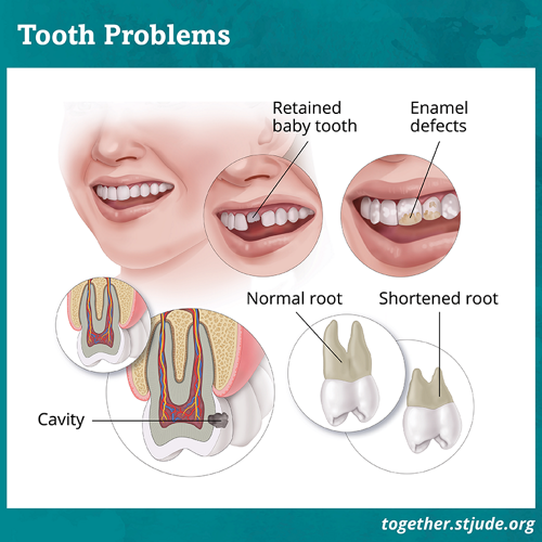 Dental Problems in Childhood Cancer Survivors - Together by St. Jude™