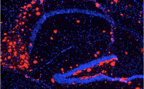 The image of red-stained β-amyloid protein and blue-stained cell nuclei all on a black background.