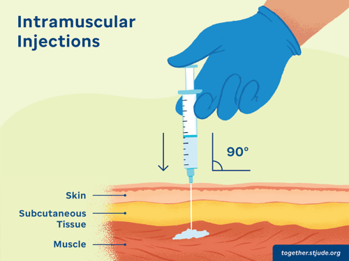 Illustration of someone giving an intramuscular injection showing the angle at 90 degrees to the skin and showing the layers of skin including subcutaneous tissue and muscle.