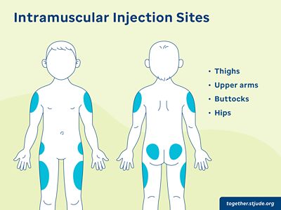 Vastus Lateralis Injection Site For Infants   MCO PED IntramuscularInjections Sites