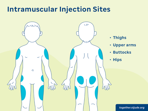 Common intramuscular injection sites