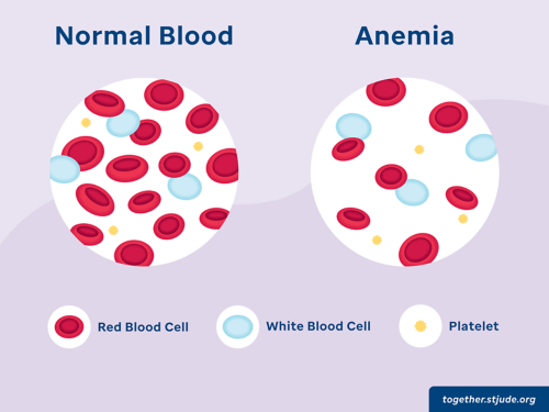 pale face anemia