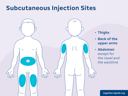 Illustration of subcutaneous injection sites