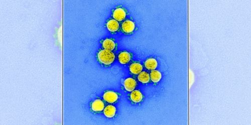 image of virus under microscope