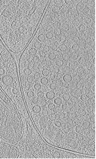 A single slice from a 3D-reconstructed Cryo-ET