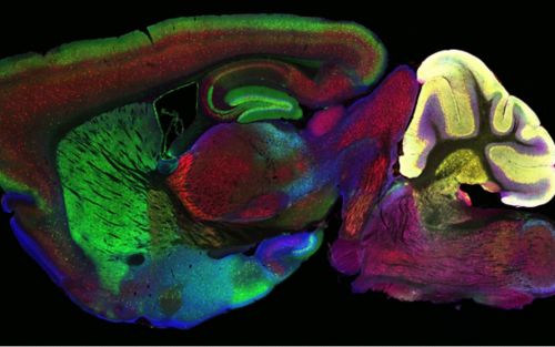 image of a mouse brain