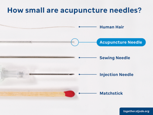As agulhas de acupuntura são muito menores em comparação com outras agulhas, um pouco mais grossas do que um fio de cabelo.