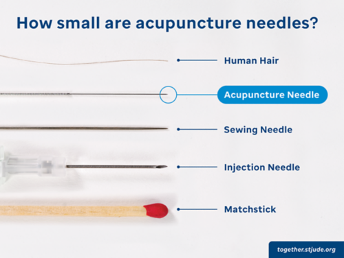 Para qué sirven las agujas de acupuntura? Conoce sus beneficios