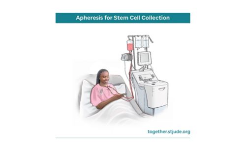 Illustration of child undergoing apheresis stem cell treatment