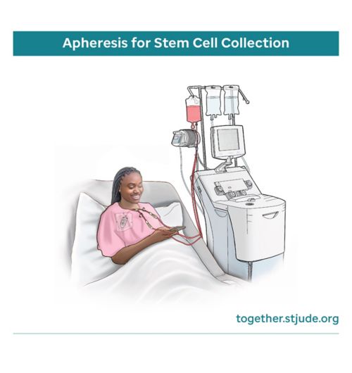 Female teen undergoing apheresis procedure for stem cell collection