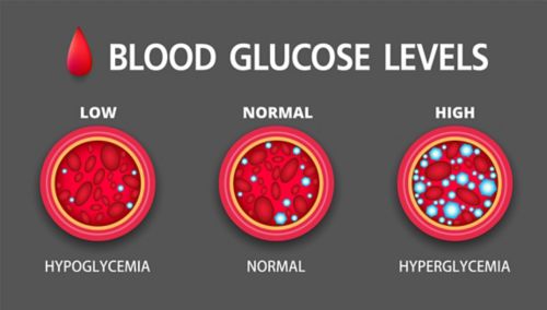 Hyperglycemia, High Blood Sugar and Diabetes ,obesity is a serious medical condition causes, vector design.