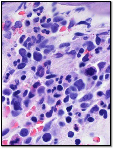 Ejemplo de portaobjetos de histología que muestra tejidos teñidos de modo que el núcleo de las células se ve de color azul y el resto de la célula, rosa.