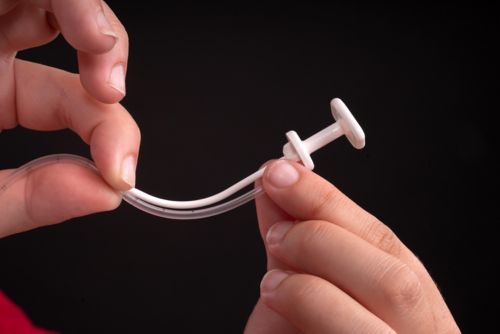 A person measuring catheter suction against the depth of obturator length.