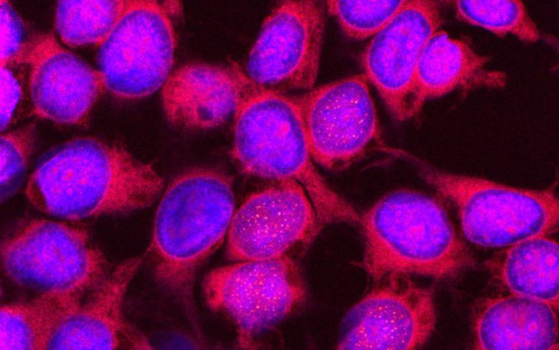 HEK293T cells transfected with GFP-tagged NUP98::LNP1