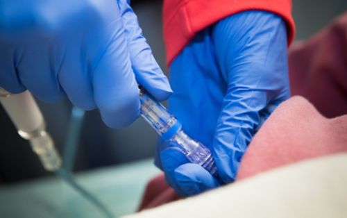 Nurse inserting chemo pump