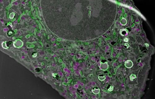 Imaging of embedded fluorescent proteins and EM tomography are combined using Correlative Light and Electron Microscopy