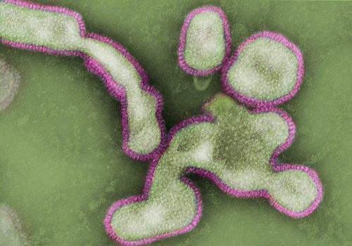 Electron micrograph of influenza virus