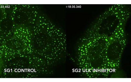 Enzymes that unlock stress granules, our cells’ biological ‘storm shelters,’ open pathway to treating muscle, brain disorders