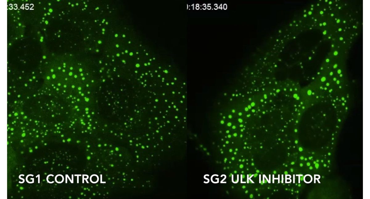 Enzymes that unlock stress granules, our cells’ biological ‘storm
