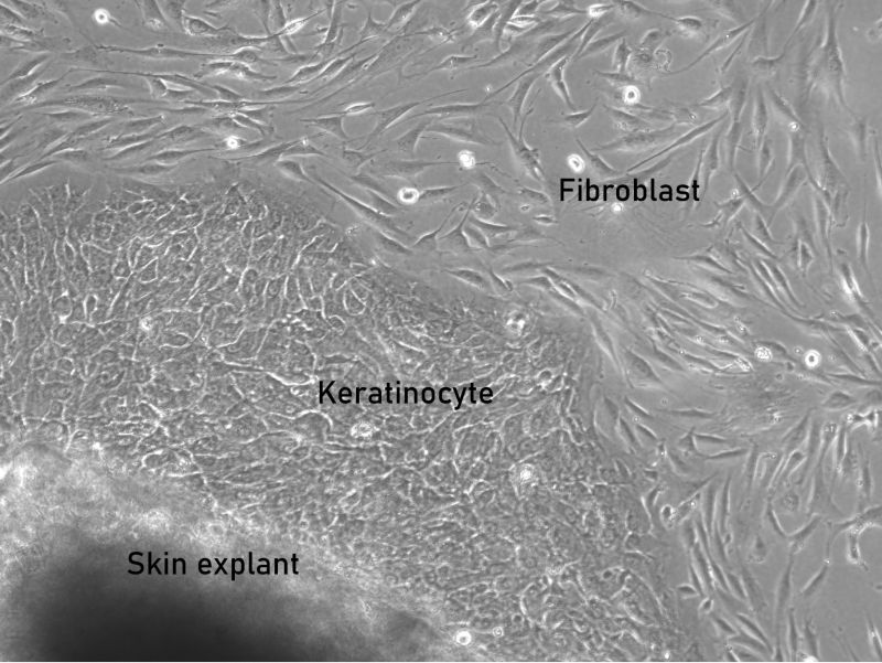 Fibroblast with labeled cell types 
