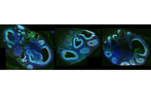 image of cerebral organoids