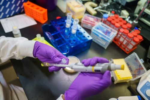 Image of hands wearing purple gloves holding a syrnige