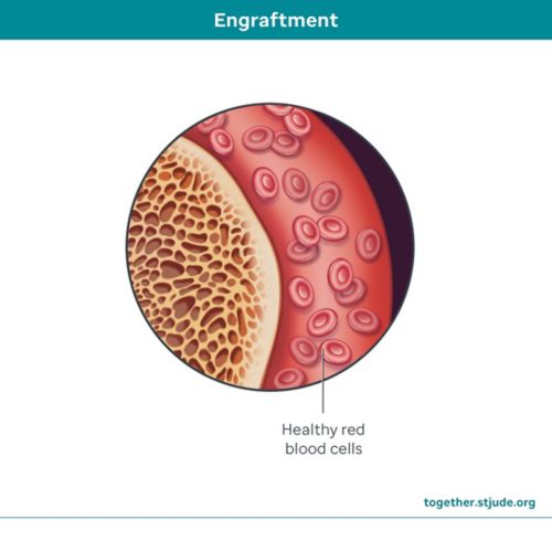 Engraftment