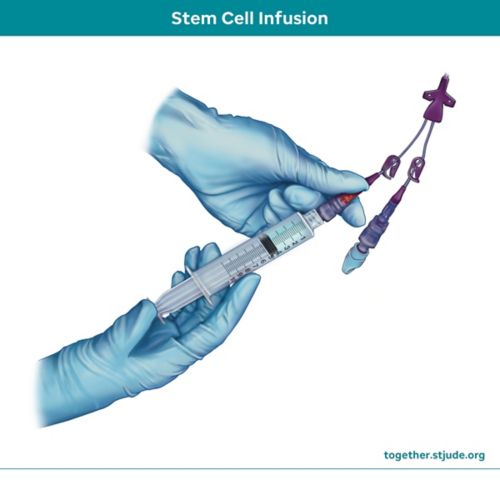 stem cell infusion