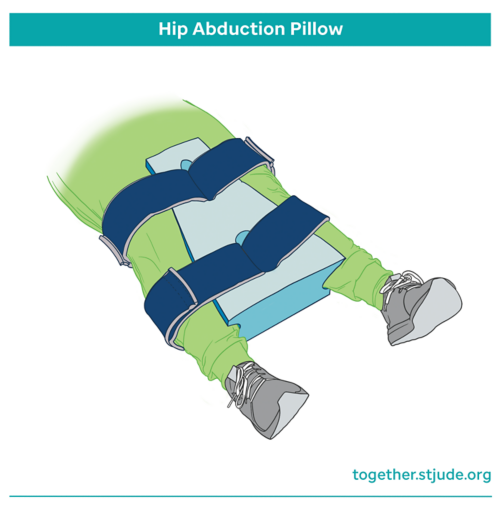 Illustration demonstrating a hip pillow attached to a patient's legs with straps
