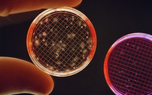 hand holding small lab dish