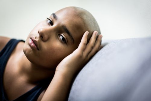 Hair loss is a common side effect of chemotherapy.