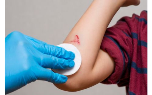 Nurse dabbing ointment on child's arm with a bloodied scrape wound