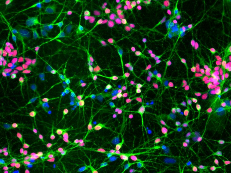 iPSC-derived neurons with MAP2 and FOXG1 staining (image credit: Mefford lab).